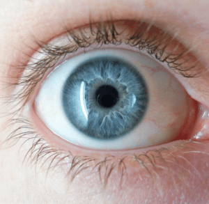 Common Eye Conditions