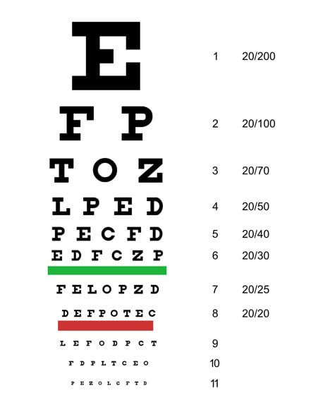 Snellen low-tech eye chart